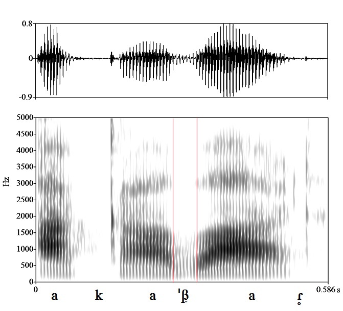 bounded audio