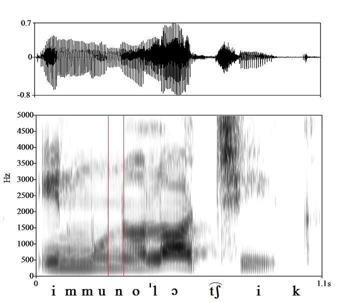 bounded audio